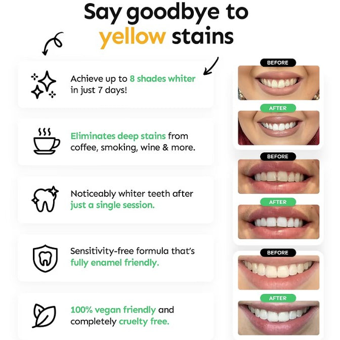 Teeth Whitening Strips
